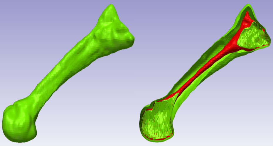 Computer generated scan showing bone composition